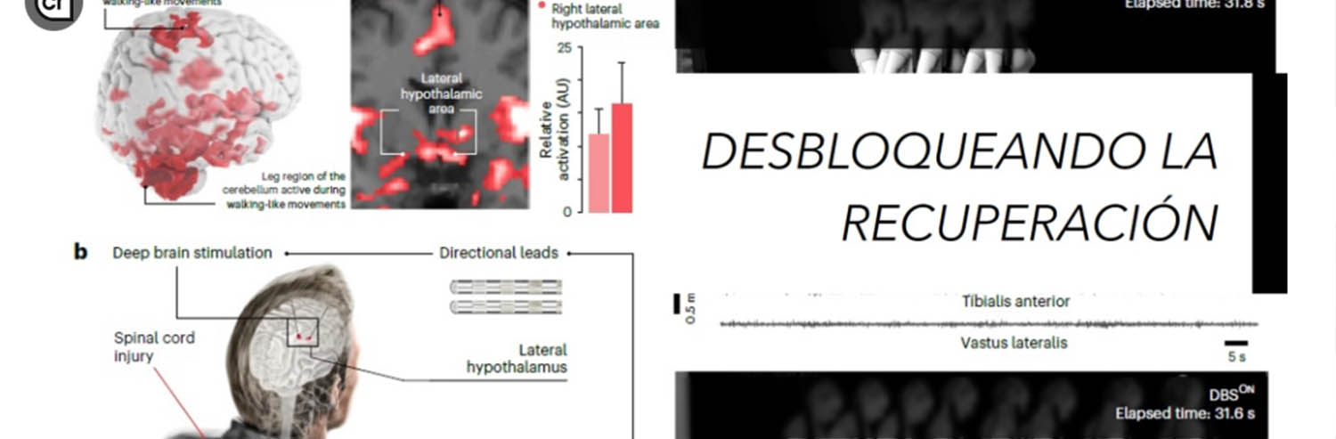 Un Nuevo Paso Hacia la Recuperación de la Marcha tras una Lesión Medular